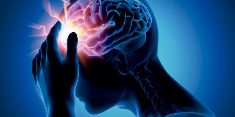 La epilepsia no discrimina edad y no toda convulsión significa que se tenga esa enfermedad